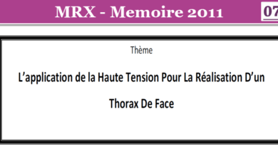 Photo of L’application de la Haute Tension Pour La Réalisation D’un Thorax De Face